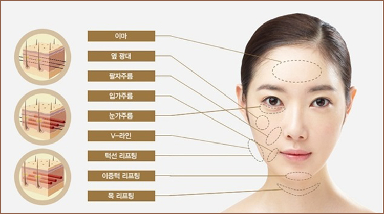 http://www.yellowclinic.com/%ED%9A%8C%EC%98%A4%EB%A6%AC%ED%94%84%ED%8C%85 회오리프팅 | 고객님의 건강과 아름다움을 책임지겠습니다.